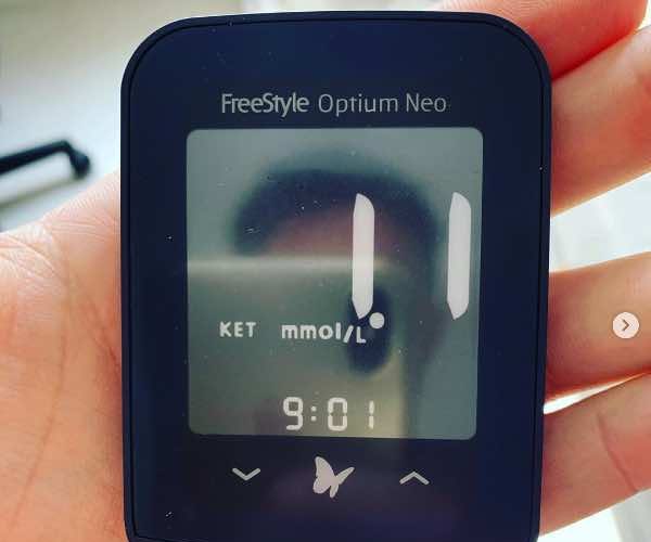 Corpos Cetonicos Circulantes